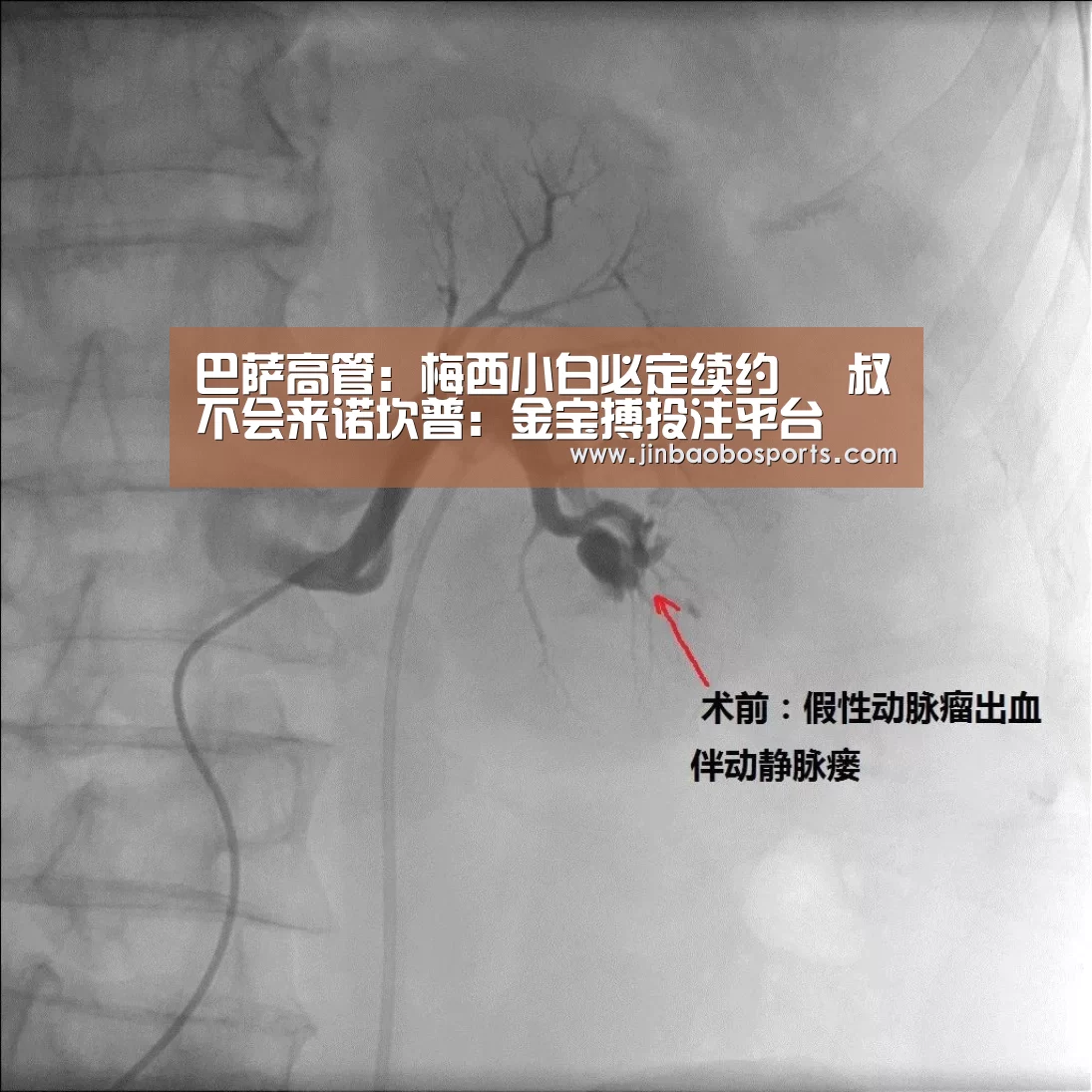 巴萨高管:梅西小白必定续约 囧叔不会来诺坎普:金宝搏投注平台(图2) 188金宝搏中国版